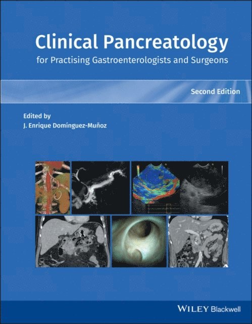 Juan Enrique Dominguez-Munoz - Clinical Pancreatology for Practising Gastroenterologists and Surgeons, E-bok