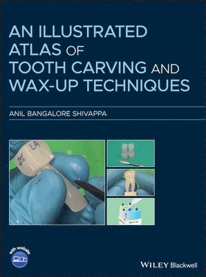Illustrated Atlas of Tooth Carving and Wax-Up Techniques av Anil Bangalore Shivappa