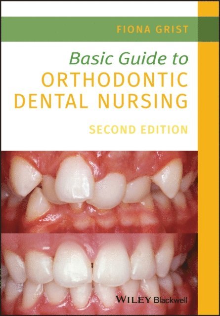 Fiona Grist - Basic Guide to Orthodontic Dental Nursing, E-bok