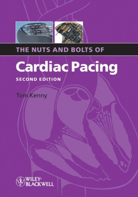 Tom Kenny - Nuts and Bolts of Cardiac Pacing, E-bok