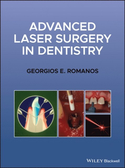 Georgios E. Romanos - Advanced Laser Surgery in Dentistry, E-bok