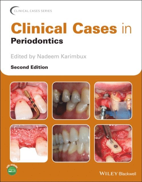 Nadeem Karimbux - Clinical Cases in Periodontics, E-bok