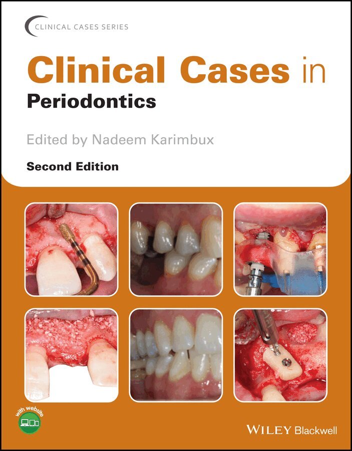 Nadeem Karimbux - Clinical Cases in Periodontics 2e. Tillgänglighet: Tillfälligt slut
