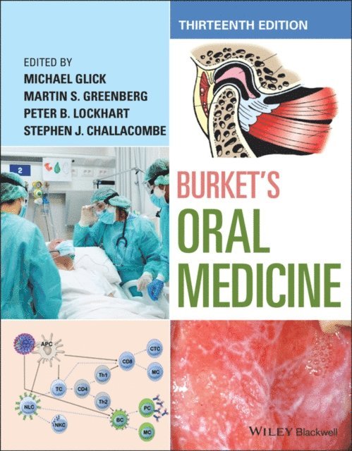 Stephen J. Challacombe, Peter B. Lockhart, Martin S. Greenberg, Michael Glick - Burket's Oral Medicine, E-bok