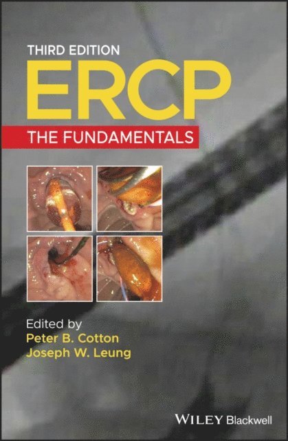 Joseph W. Leung, Peter B. Cotton - ERCP, E-bok