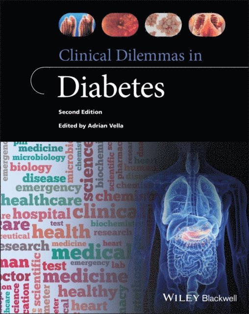 Adrian Vella - Clinical Dilemmas in Diabetes, E-bok