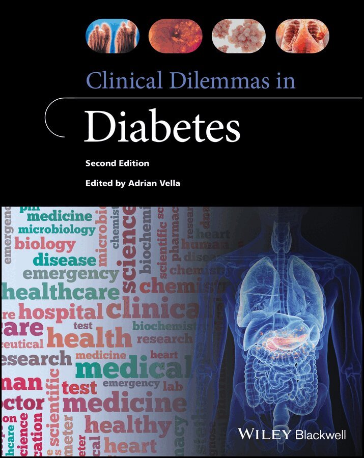 Adrian Vella - Clinical Dilemmas in Diabetes 2e. Tillgänglighet: Tillfälligt slut