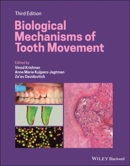 Ze'ev Davidovitch, Anne Marie Kuijpers-Jagtman, Vinod Krishnan - Biological Mechanisms of Tooth Movement, E-bok