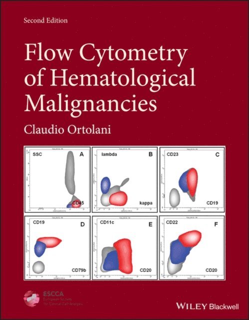Claudio Ortolani - Flow Cytometry of Hematological Malignancies, E-bok