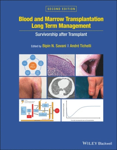 Andre Tichelli, Bipin N. Savani - Blood and Marrow Transplantation Long Term Management, E-bok