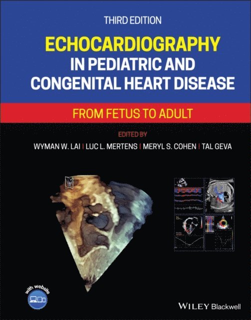 Tal Geva, Meryl S. Cohen, Luc L. Mertens, Wyman W. Lai - Echocardiography in Pediatric and Congenital Heart Disease, E-bok