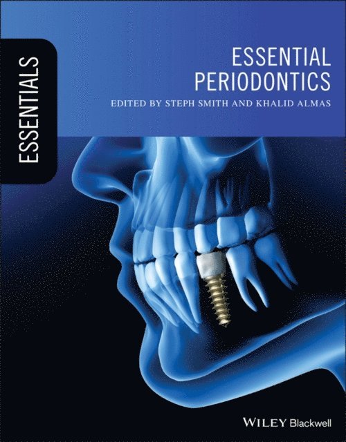 Khalid Almas, Steph Smith - Essential Periodontics, E-bok