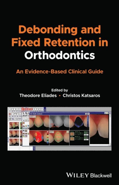 Christos Katsaros, Theodore Eliades - Debonding and Fixed Retention in Orthodontics, E-bok