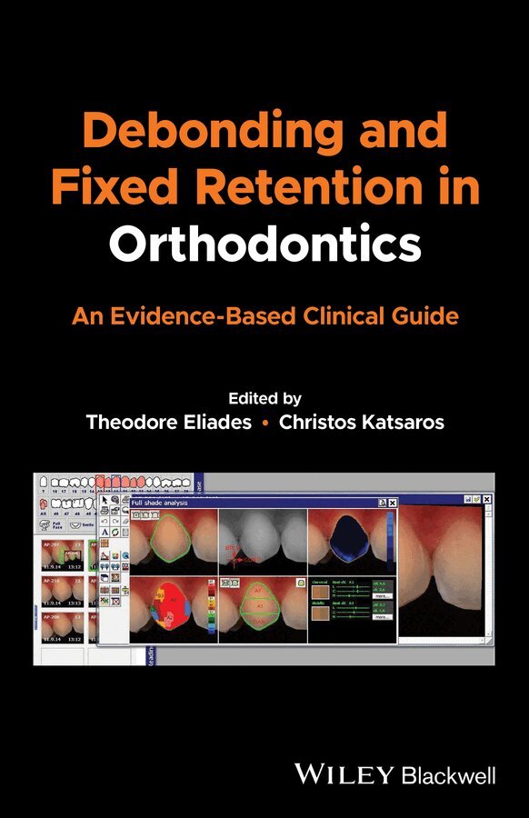Theodore Eliades, Christos Katsaros - Debonding and Fixed Retention in Orthodontics: An Evidence–Based Clinical Guide. Tillgänglighet: Tillfälligt slut