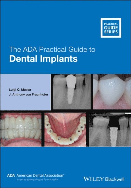 J. Anthony von Fraunhofer, Luigi O. Massa - ADA Practical Guide to Dental Implants, E-bok