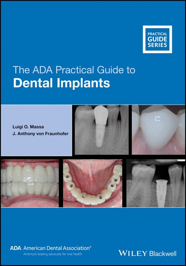 Luigi O. Massa, J. Anthony von Fraunhofer - ADA Practical Guide to Dental Implants oBook. Tillgänglighet: Tillfälligt slut