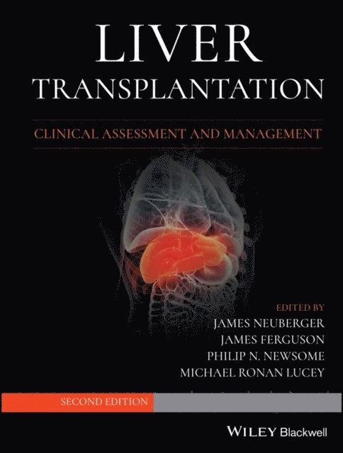 Michael R. Lucey, Philip N. Newsome, James Ferguson, James Neuberger - Liver Transplantation, E-bok
