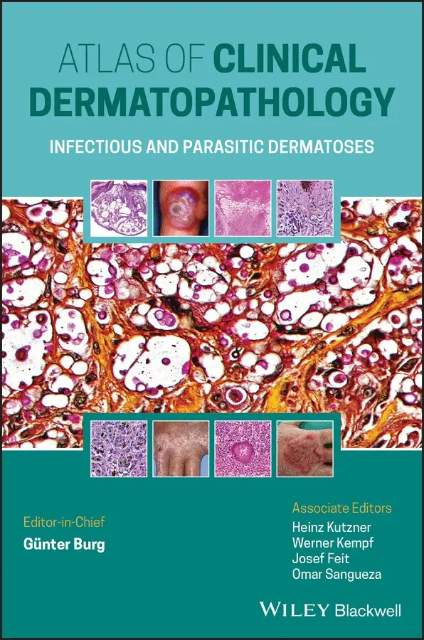 G Burg - Atlas of Clinical Dermatopathology – Infectious and Parasitic Dermatoses. Tillgänglighet: Tillfälligt slut