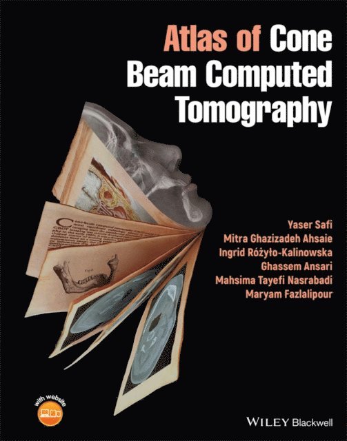 Maryam Fazlalipour, Mahsima Tayefi Nasrabadi, Ghassem Ansari, Ingrid R  y o-Kalinowska, Mitra Ghazizadeh Ahsaie, Yaser Safi - Atlas of Cone Beam Computed Tomography, E-bok