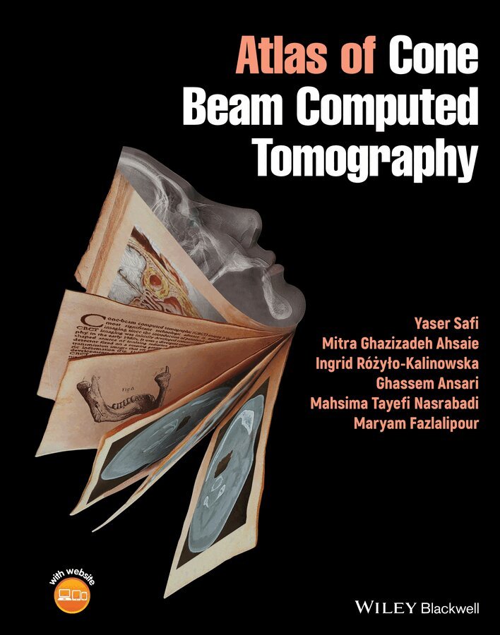 Yaser Safi, Mitra Ghazizadeh Ahsaie, Ingrid Różyło-Kalinowska, Ghassem Ansari, Mahsima Tayefi Nasrabadi, Maryam Fazlalipour - Atlas of Cone Beam Computed Tomography. Tillgänglighet: Tillfälligt slut