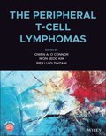 Peripheral T-Cell Lymphomas