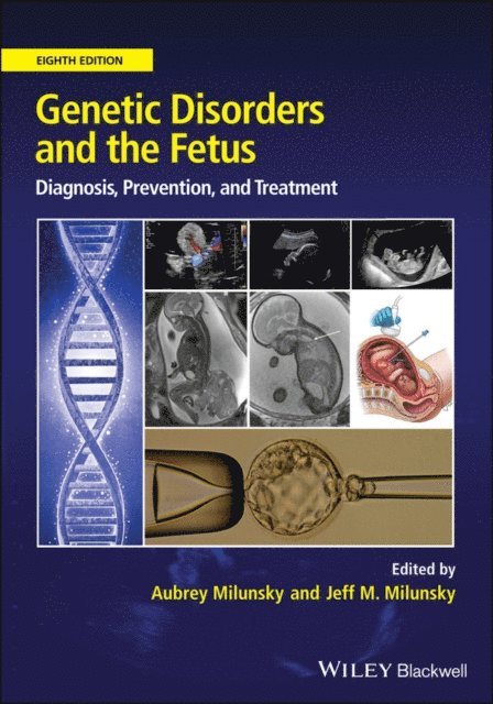 Jeff M. Milunsky, Aubrey Milunsky - Genetic Disorders and the Fetus, E-bok
