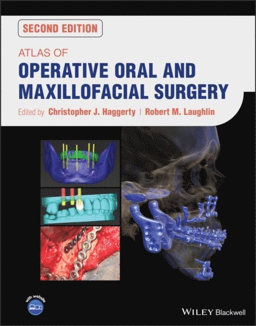 Robert M. Laughlin, Christopher J. Haggerty - Atlas of Operative Oral and Maxillofacial Surgery, E-bok