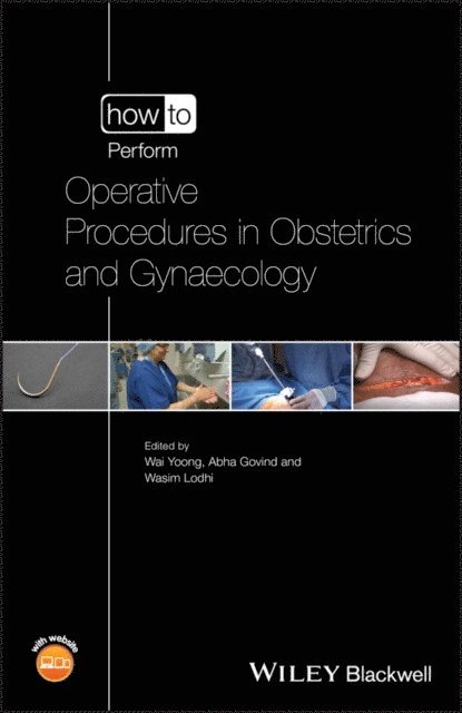 Wasim Lodhi, Abha Govind, Wai Yoong - How to Perform Operative Procedures in Obstetrics and Gynaecology, E-bok
