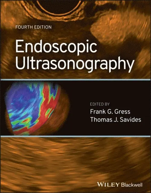 Thomas J. Savides, Frank G. Gress - Endoscopic Ultrasonography, E-bok. Tillgänglighet: Lägg i varukorg