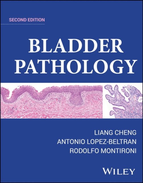 Rodolfo Montironi, Antonio Lopez-Beltran, Liang Cheng - Bladder Pathology, E-bok