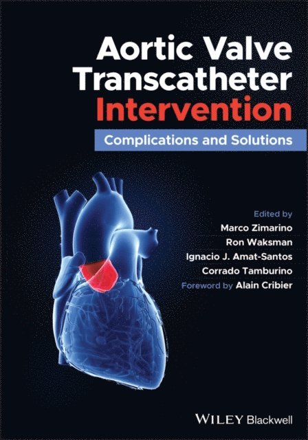 Corrado Tamburino, Ignacio J. Amat-Santos, Ron Waksman, Marco Zimarino - Aortic Valve Transcatheter Intervention, E-bok