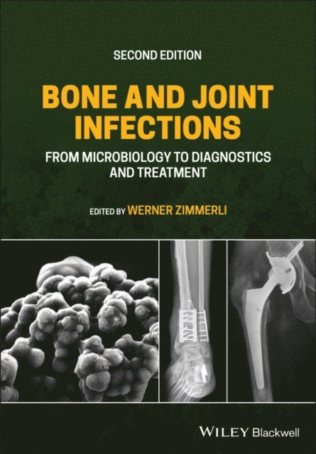 Werner Zimmerli - Bone and Joint Infections, E-bok