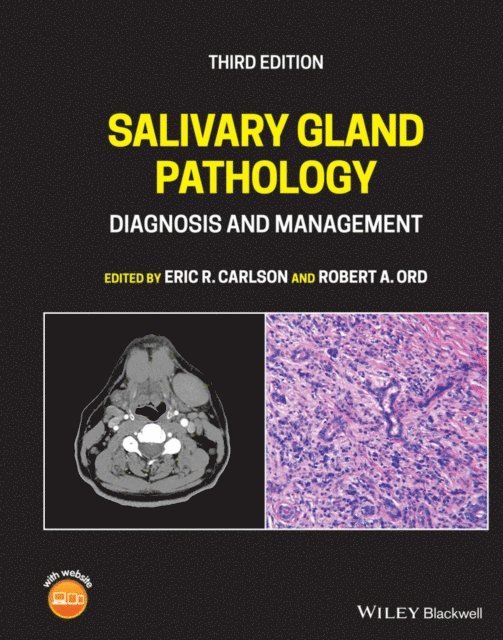 Robert A. Ord, Eric R. Carlson - Salivary Gland Pathology, E-bok