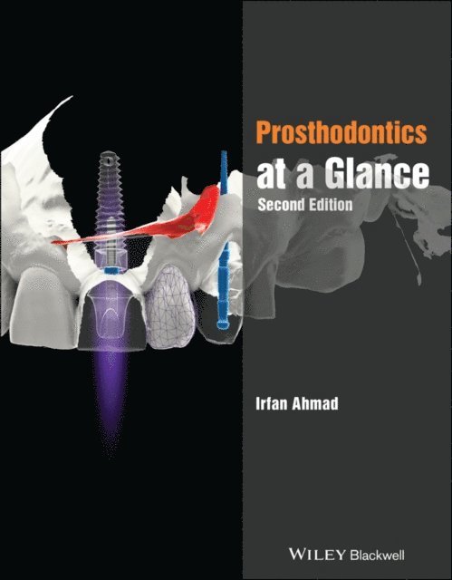 Irfan Ahmad - Prosthodontics at a Glance, E-bok