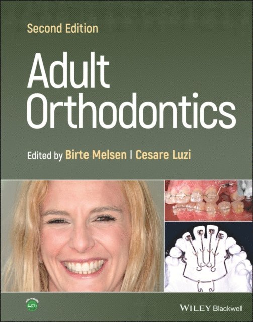 Cesare Luzi, Birte Melsen - Adult Orthodontics, E-bok