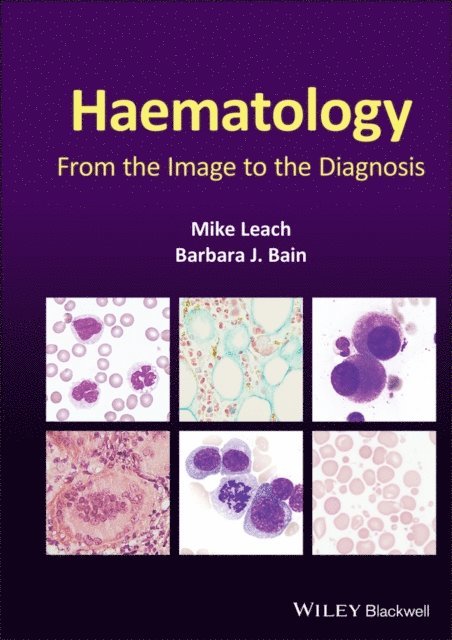 Barbara J. Bain, Mike Leach - Haematology, E-bok