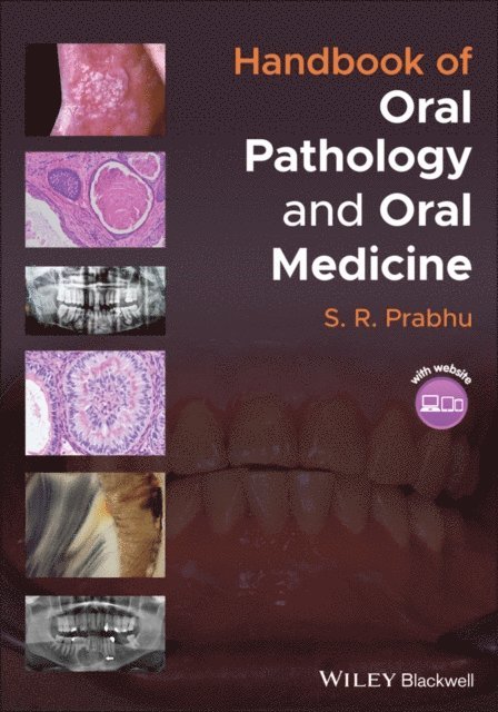 S. R. Prabhu - Handbook of Oral Pathology and Oral Medicine, E-bok