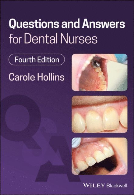 Carole Hollins - Questions and Answers for Dental Nurses, E-bok