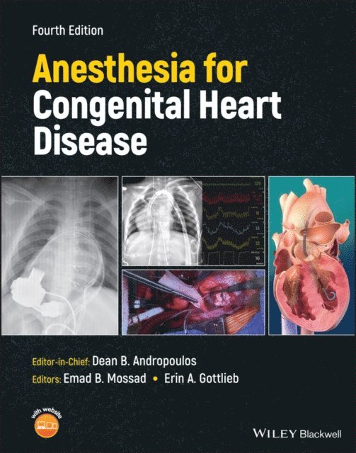 Erin A. Gottlieb, Emad B. Mossad - Anesthesia for Congenital Heart Disease, E-bok