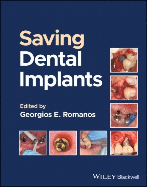 Georgios E. Romanos - Saving Dental Implants, E-bok