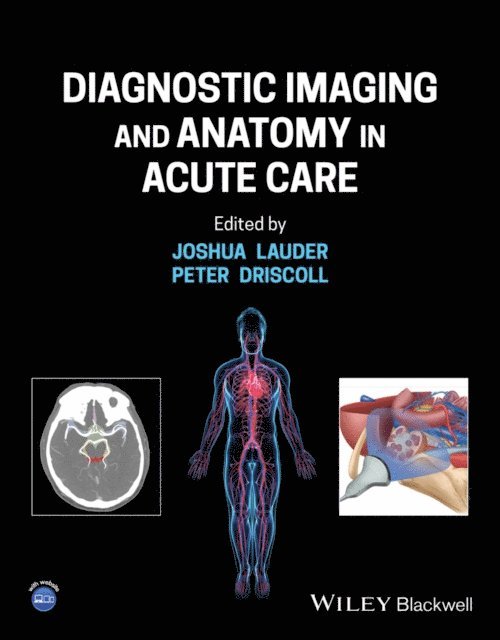 Peter Anthony Driscoll, Joshua Lauder - Diagnostic Imaging and Anatomy in Acute Care, E-bok