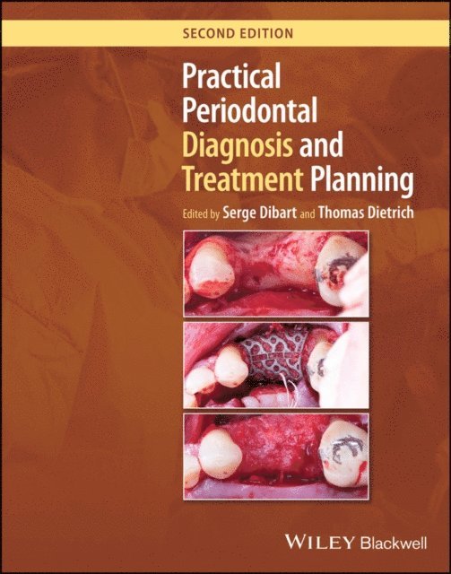 Thomas Dietrich, Serge Dibart - Practical Periodontal Diagnosis and Treatment Planning, E-bok