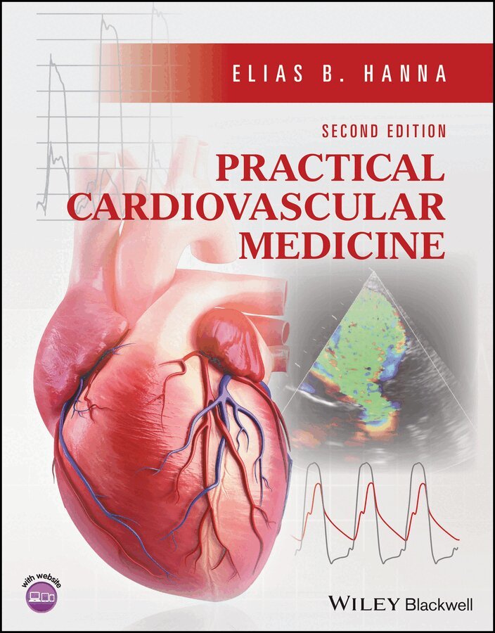Elias B. Hanna - Practical Cardiovascular Medicine 2e, Övrigt. Tillgänglighet: Tillfälligt slut