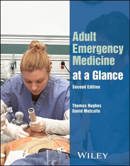 David Metcalfe, Thomas Hughes - Adult Emergency Medicine at a Glance, E-bok