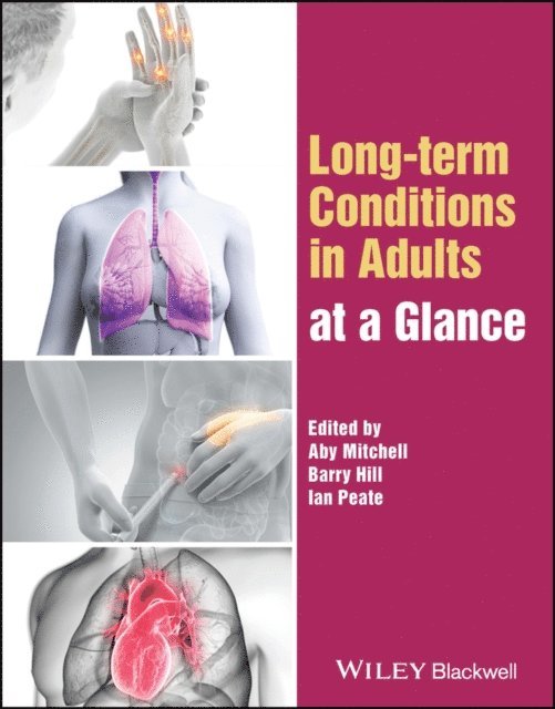Ian Peate, Barry Hill, Aby Mitchell - Long-term Conditions in Adults at a Glance, E-bok