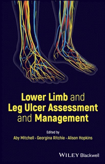 Alison Hopkins, Georgina Ritchie, Aby Mitchell - Lower Limb and Leg Ulcer Assessment and Management, E-bok