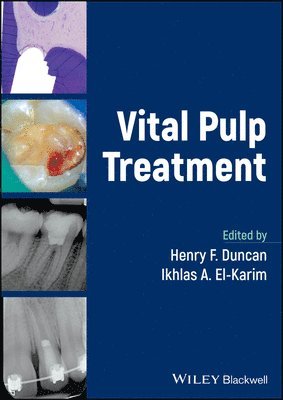 Henry F. Duncan, Ikhlas A. El-Karim - Vital Pulp Treatment, Inbunden