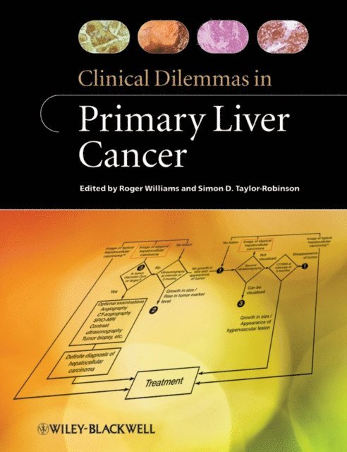 Simon D. Taylor-Robinson, Roger Williams - Clinical Dilemmas in Primary Liver Cancer, E-bok