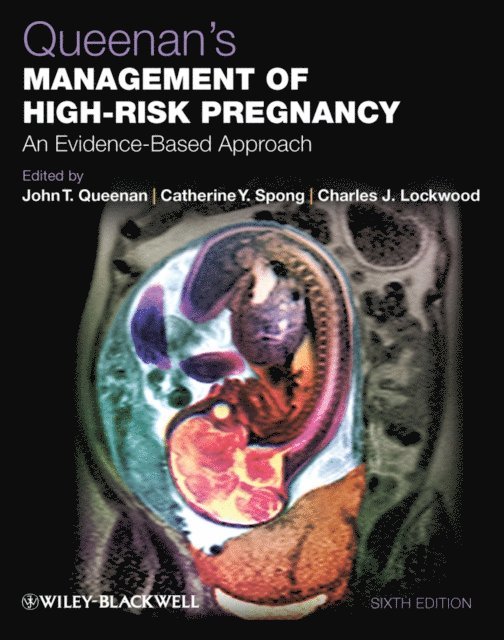Charles J. Lockwood, Catherine Y. Spong, John T. Queenan - Queenan's Management of High-Risk Pregnancy, E-bok