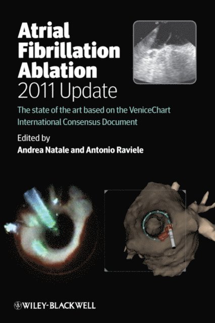 Antonio Raviele, Andrea Natale - Atrial Fibrillation Ablation, 2011 Update, E-bok